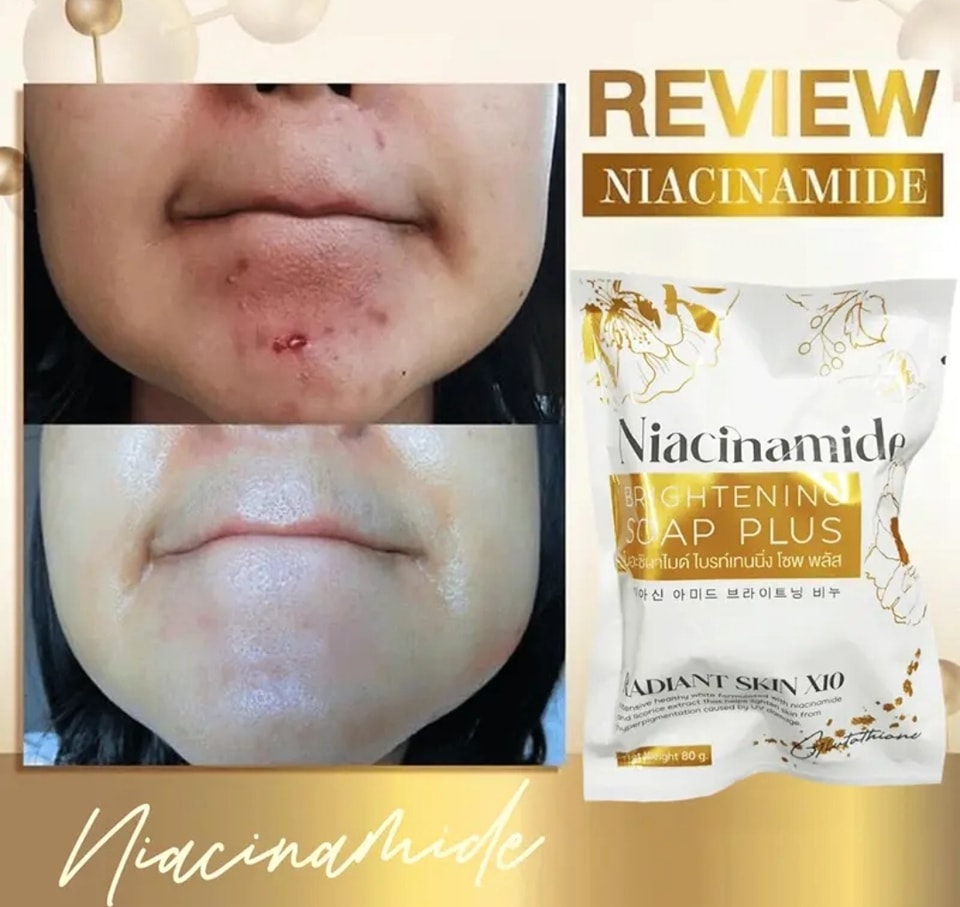 NIACINAMIDE BRIGHTENING SOAP PLUS Authentic from Thailand